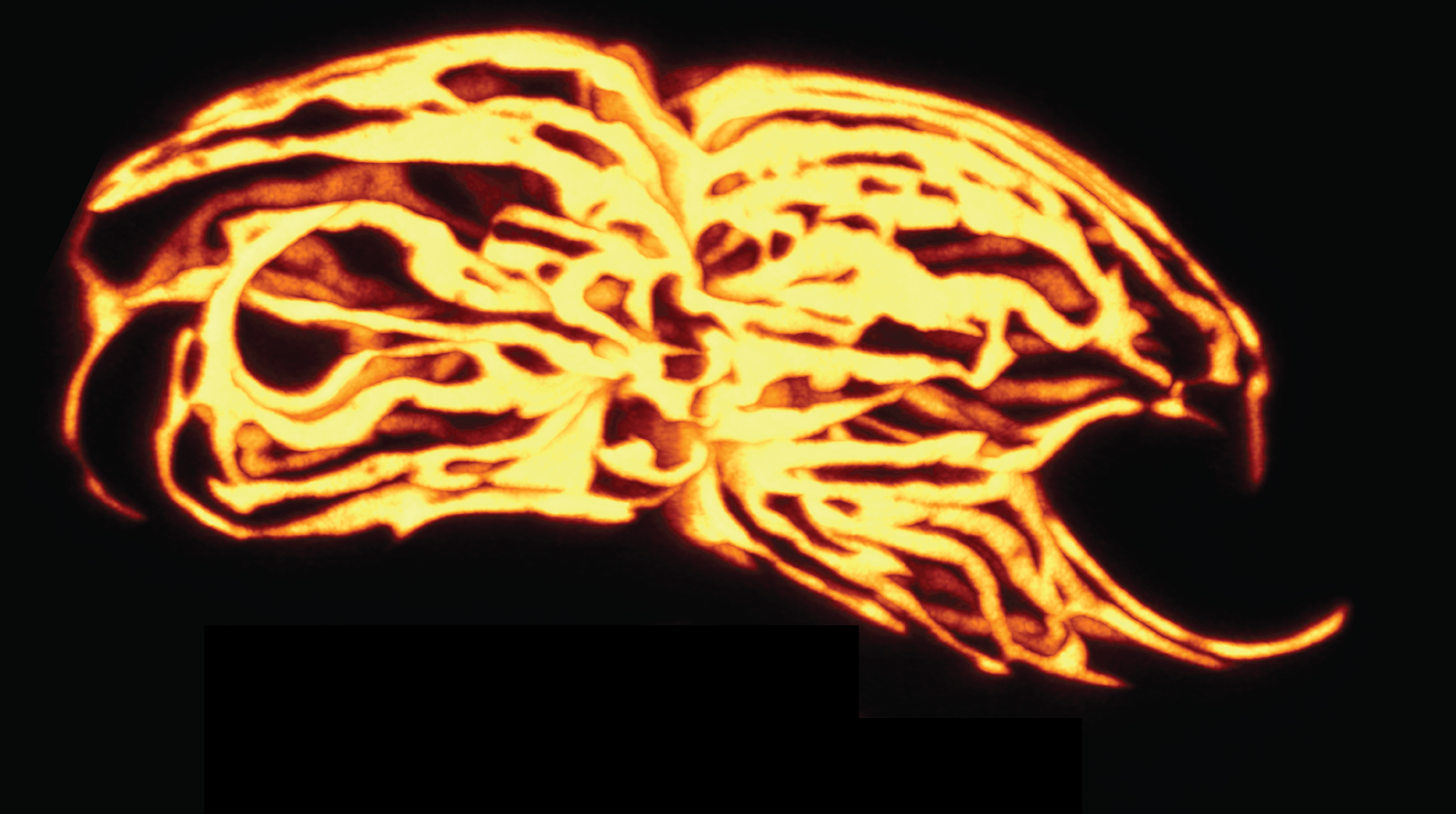 Red chloroplast network of Pyrocystis lunula.