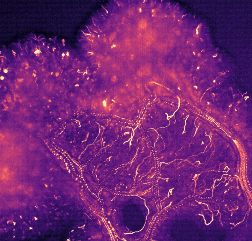 Streamlines of fluorescently tagged nuclei in a front region of Physarum polycephalum.